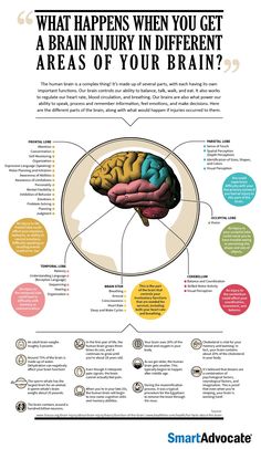 the brain and its functions are shown in this info sheet, which shows what happens when you