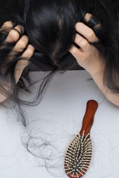 Hair Fall Remedy, Hair Aesthetics, Hair Falling, Prp Hair, Dunner Wordend Haar, Home Remedies For Hair, Hair Shedding, Hair Control, Lost Hair