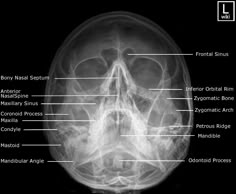 an x - ray image shows the location of the skull's bones and its major structures