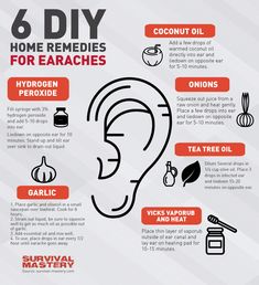 Ear Ache, Diy Remedies, Cold Remedies, Natural Therapy, Natural Health Remedies