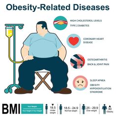 Obesity Awareness, Foot Reflexology Massage, Boarding Schools, High Cholesterol Levels, Normal Weight, Reflexology Massage, Foot Reflexology, Best Hospitals