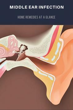 The symptoms of the disease can be easily controlled with otitis media. Here we give an overview of all home remedies. Home Remedies Ear Ache, Ear Ache Remedy For Adults, Ear Infections Remedy For Adults, Ear Infections In Adults, Liver Care, Sick Remedies, Middle Ear, Ear Health, Nursing Notes