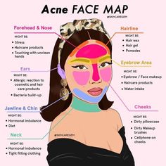 Gesicht Mapping, Acne Face Map, Face Map, Obličejové Masky, Face Mapping Acne, Haut Routine, Skin Advice, Face Mapping, Skin Care Routine Order