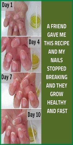 How To Grow Nails, Nail Growth, Strong Nails, Cool Ideas, Healthy Nails, Fitness Beauty, Up Girl, Beauty Secrets, Diy Beauty