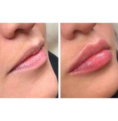 Lip Color Tattoo, Full Lips Makeup, Smooth Skin Body, Beauty Procedures