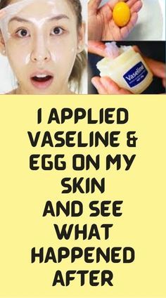 Home Remedies For Wrinkles, Vaseline Beauty Tips, Natural Face Skin Care, Skin Care Wrinkles