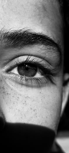 black and white photograph of an eye with freckles on it's eyes