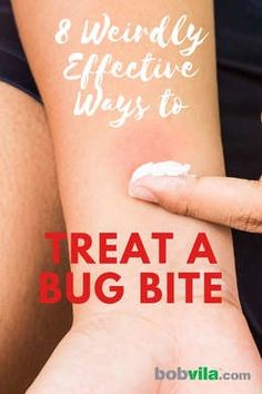 How To Help Bug Bites, How To Treat Mosquito Bits, Itchy Bug Bite Remedy, Infected Bug Bite, Treating Spider Bites, Bed Bug Bites Remedies, Bug Bite Swelling, Treating Mosquito Bites, Bug Bite Itch Relief