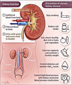 Improve Kidney Function, Kidney Pain, Creatinine Levels, Kidney Function, Renal Diet, Chronic Kidney, Kidney Health, Nursing Notes, Medical Knowledge