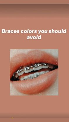 Aesthetic Braces Colors Ideas, Braces Aesthetic Girl, Best Braces Colors Ideas, Good Braces Colors, Braces Colors Aesthetic, Aesthetic Braces, Best Braces Colors, Braces Colours, Braces Tips