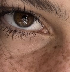 Pale Skin With Freckles Aesthetic, Brown Eyes And Freckles Aesthetic, Freckled Skin Aesthetic, Freckles Aesthetic Faceless, Cute Freckles Aesthetic, Brown Woman Aesthetic, Pale Skin With Freckles, Freckle Aesthetic