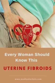 Find Permanent Relief from Uterine fibroids with Ayurvedic treatment, diet, yoga and natural remedies. Shrink fibroids naturally and Avoid surgery. Heavy Menstrual, Fibroid Diet, Fibroid Uterus, Dong Quai, Fibroid Tumors, Ayurvedic Remedies, Ayurvedic Herbs, Health Remedies