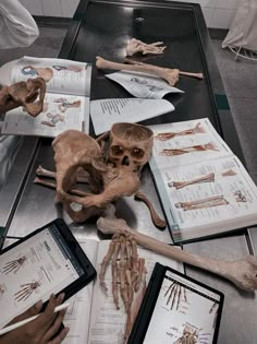 several human bones are displayed on a table with electronic devices and medical equipment in front of them