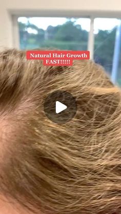 Anne Caserta on Instagram: "Start stimulating your hair growth with just a few natural ingredients laying around in your house #hairgrowthtips" Hair Growth At Home, Longer Hair Faster, Fast Hair Growth, Fast Hair, Grow Long Hair, Hair Growth Serum, Get Crazy, Grow Hair Faster