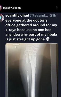 an x - ray is shown with the caption that reads, i'm not really