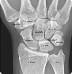 an x - ray image shows the bones of the foot and ankle, with different types of bones labeled below