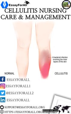 the legs and ankles are shown with information about how to use them for medical purposes