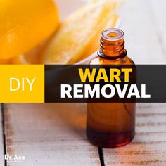 Diy Wart Removal, Essential Oils Warts, Oregano Oil Benefits, Warts Remedy, Wart Remover, Oregano Essential Oil, Lemon Essential Oil, Oil Remedies, Oregano Oil