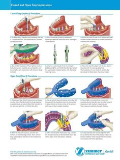 good dental care Dental Assistant School, Dental Assistant Study, Dentist Assistant, Dental Clinic Logo, Dental Implant Procedure, Dental Impressions, Dental Restoration, Dental Videos, Dental Jokes