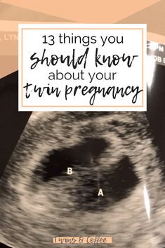 an x - ray image with the words 13 things you should know about your turn pregnant