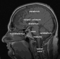 an mri scan shows the location of the cerebrum and thalamus