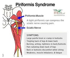 Psoas Exercises, Piriformis Syndrome Symptoms, Psoas Release, Muscle Imbalance, Muscle Anatomy