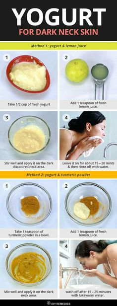 Remedy For Dark Neck, Neck Acne, Natural Skin Care Remedies, Good Skin Tips, Perfect Skin Care Routine