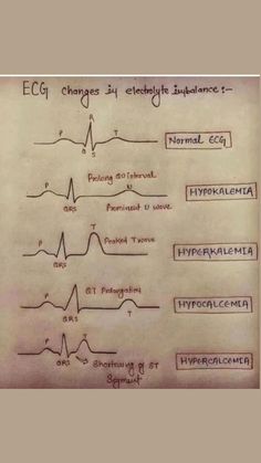 Electrolyte Imbalance, Learn Biology, Medical Student Motivation