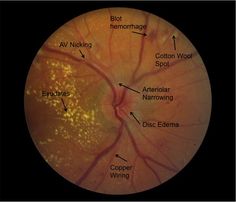 an image of the structure of the eye