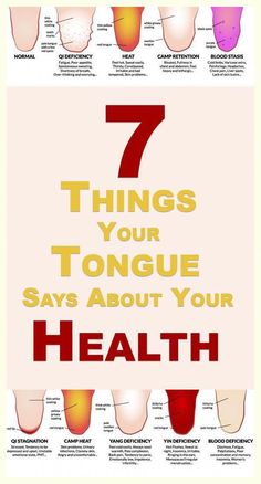 Tongue Health by Kathryn Logsdon | This newsletter was created with Smore, an online tool for creating beautiful newsletters for educators, nonprofits, businesses and more Health Signs, Tongue Health, Feeling Hot, Shortness Of Breath, Chest Pain, Nail Health, Traditional Chinese Medicine, Chinese Medicine, Oral Hygiene