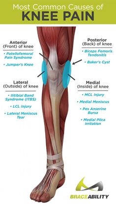 Mcl Injury, Knee Pain Exercises, Nerve Pain Relief, Knee Exercises, Knee Pain Relief, Yoga Iyengar, Sciatic Nerve, Knee Injury, Nerve Pain