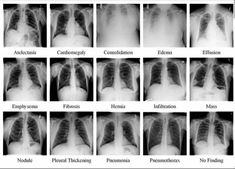 Radiology Humor, Radiology Tech, Medicine Studies