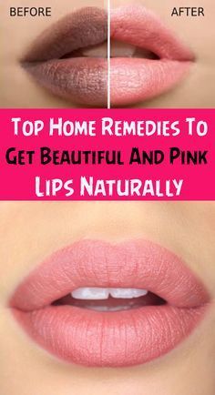 Tips For Pink Lips, Get Pink Lips, Remedies For Dark Lips