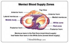 An overview of common diagnostic tests used for diagnosing a meniscus injury of the knee. Medial Meniscus, Meniscus Injury, Meniscus Surgery, Knee Rehab, Meniscal Tear, Runners Knee, Body Joints, Knee Exercises, Knee Pain Relief