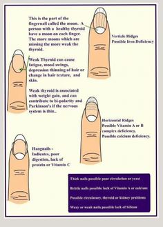 Fix Broken Nail, Deficiency Symptoms, Broken Nails, Body Anatomy, Body Healing, Anatomy, Healing, Nails, Health