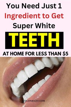 Toothache Relief, Teeth Whitening Methods