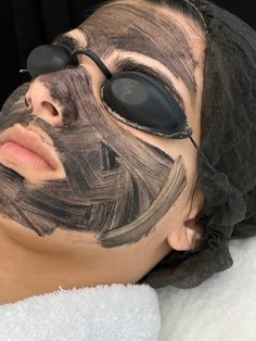 Carbon Peeling Laser, Hollywood Facial, Carbon Laser Facial, Hollywood Peel, Carbon Facial, Salon Marketing Social Media, Facial Pics, Carbon Laser