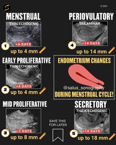 an info sheet shows the stages of menstrual surgery