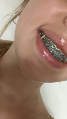 #tealbraces #braces #bracescolors Teal Braces