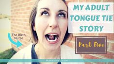 AHHHH! I just found this gem in all of my tongue tie videos and I had to add it to my series! I'll call it Part 5. Who can resist a Day After update?! Follow... Tongue Tie Release, Tongue Tie Exercises, Talking Behind Your Back, Laser Removal, Oral Motor, 19 Years Old, Nerve Pain Relief, Tongue Tie