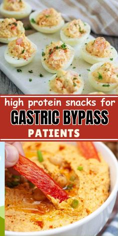 Looking for healthy snacks after bariatric surgery? This guide offers a variety of tasty options to help you stay on track with your wellness goals, without sacrificing flavor!bariatric snacks. high protein bariatric recipes.bariatric recipes sleeve. bariatric meal prep.vsg recipes Sleeve Bariatric, Bariatric Snacks, Vsg Recipes, Protein Treats, Wellness Goals, Nutritious Diet, High Protein Snacks, Protein Snacks