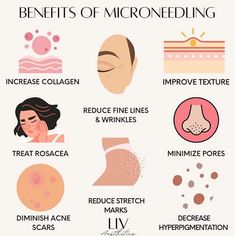 With all of these great benefits, why haven't you tried Microneedling yet???? 🤔 #medspa #microneedling #skincare #selfcare Skin Care Treatments Faces, Skin Care Fun Facts, Self Care Treatments, Microbrasion Facial, Microneedling Marketing, Rf Microneedling Benefits, Med Spa Instagram Post, Micro Needling Benefits, Microneedling After Care