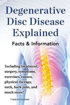 Degenerative Disc Disease Explained. Including Treatment, Surgery, Symptoms, Exercises, Causes, Physical Therapy, Neck, Back, Pain, and Much More! Fac Neck And Back Pain, Joints Pain Relief, Nerve Pain, Back Exercises, Back Pain Relief, Sciatica, Health Info, Neck Pain