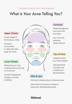 Acne 101 l What Is Acne Telling You? Face Mapping Your Acne What Different Areas Of Acne Mean, Reasons Why You Have Acne, What Is Causing My Acne, Placement Of Pimples Meaning, What Does Ur Acne Mean, What My Acne Is Telling Me, Skin Breakout Chart, Why Acne Is Where It Is, What Different Places Of Acne Mean