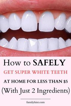 Whiten Teeth Naturally, Tooth Whitening, Teeth Whitening Remedies, Diy Teething, Whitening Products