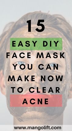 15 Amazing Easy DIY Face Mask You Can Make Now to Clear Acne Doterra Acne, Natural Face Moisturizer, Routine Daily, Acne Face Mask, Green Tea Mask, Routine Tips