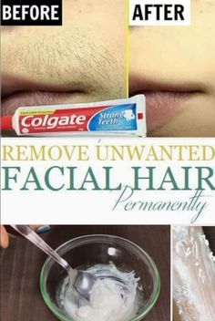 How To Remove Unwanted Facial Hair Permanently. Remove facial hair permanently at home quick and easily, with this simple DIY homemade facial hair recipe. Diy Hair Removal Cream, Diy Hair Removal, Diy Facial Hair Removal, Facial Hair Removal For Women, Chin Hair Removal, Face Hair Removal, Thick Hair Remedies