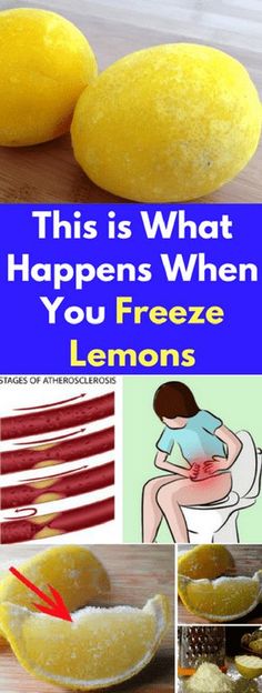 This is What Happens When You Freeze Lemons Freeze Lemons, Frozen Lemon, Drinking Lemon Water, Lemon Water, What Happens When You, Finger Food, Health Remedies