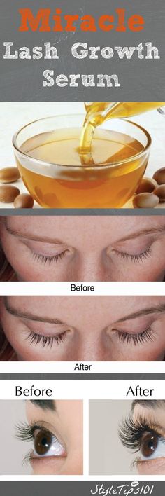 Grow Eyelashes, Health Coconut Oil, Lash Growth Serum, Lash Growth, Coconut Oil Uses, Hair Growth Serum, Eyelash Growth, Beauty Remedies