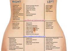 Abdominal Regions, Forensic Nursing, Stomach Health, Lower Abdominal Pain, Large Bowel, Education Video, Differential Diagnosis, Medical Mnemonics, Vein Thrombosis